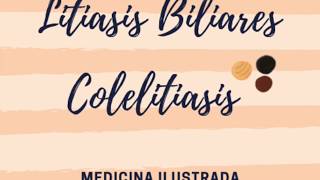 Colelitiasis cálculos o piedras Biliares [upl. by Sorodoeht]