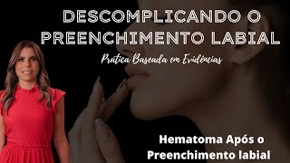 Hematoma após o Preenchimento labial Quando é normal [upl. by Ahcorb]