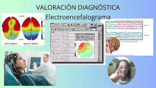 TC Resonancia magnética Electroencefalograma y punción lumbar  Función Neurológica 5 [upl. by Adyela644]