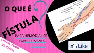 FÍSTULA PARA HEMODIÁLISE O QUE É  PARA QUE SERVE [upl. by Aicinat]