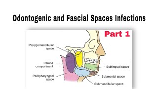 Odontogenic and Fascial Spaces Infections طب الأسنان مرحلة رابعة oralsurgery [upl. by Udale]