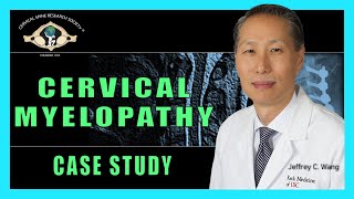 Cervical Myelopathy  Case Presentation Symposia 3 Part 1  Dr Jeffrey C Wang [upl. by Mcclain279]