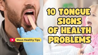 10 Tongue Signs of Health Problems [upl. by Bradlee]