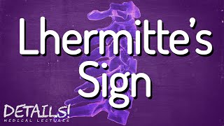 Lhermittes Sign  Multiple Sclerosis  Details [upl. by Janek]