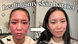 how i repaired my skin barrier not sponsored [upl. by Aicilev902]