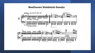 Beethoven Waldstein Sonata Nelson Freires Performance with Sheet Music 1st 2nd and 3rd movement [upl. by Westerfield960]