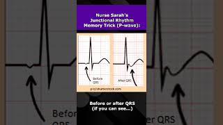 Junctional Rhythms ECG Nursing Mnemonic NCLEX EKG Review [upl. by Halet]