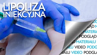 Zabieg wyszczuplający czyli lipoliza iniekcyjna [upl. by Atiekahs191]