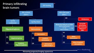 Emergency Imaging of Brain Tumors Classification [upl. by Aryajay]