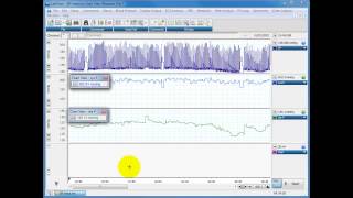 Calculating systolic diastolic and MAP from blood pressure traces [upl. by Ehr23]