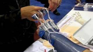 Splinting Video from AOTA Conference Part 2 [upl. by Malinin]