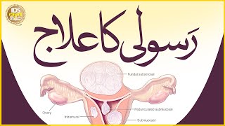 Rasoli Ka Ilaaj  رسولی کا حل  Rasoli Ki Alamat  Mufti Ghulam Dastageer Qadri  IDS Rohani Ilaaj [upl. by Martita100]