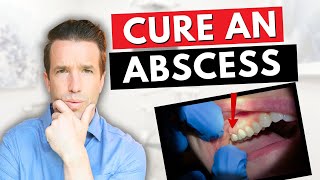 Dentist Explains a Tooth Abscess  How to Cure an Abscess Tooth [upl. by Edyak]