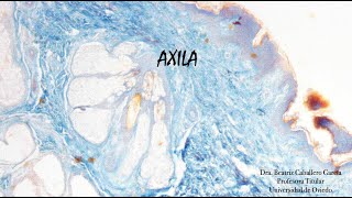 Axila Tricrómico [upl. by Odoric]