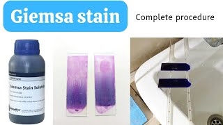 Giemsa Stain Procedure for Blood SmearHow to do Giemsa StainGiemsa Staining ProcedureAdnanMLT [upl. by Naahsar]