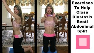 Exercises To Help CloseRepair a Diastasis Recti 2 Abdominal Split Separation [upl. by Annabela]