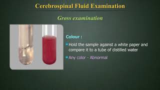 Cerebrospinal Fluid Examination CSF [upl. by Enenstein165]