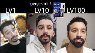 MİNOXİL MiİNOXİDİL GERÇEK Mİ  SAKAL DEĞİŞİMİ [upl. by Melodee]