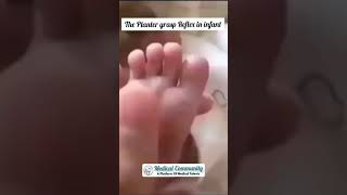 Plantar Grasp Reflex in an infantBabinski Reflex বাচ্চাদের প্লান্টার গ্রাস্প রিফ্লেক্স [upl. by Ilojna]