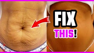 💥 How to avoid loose skin after weight loss Preventing loose skin during weight loss [upl. by Aleibarg]