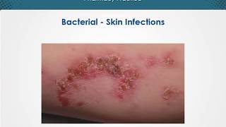 Bacterial skin infections  Dermatology  EduRx [upl. by Mcgee872]