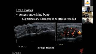 Radiological Approach to Soft Tissue Bumps and Sarcomas [upl. by Iva]