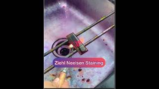 Ziehl Neelsen stainingZN stainingAFB staining Afb tb znstain [upl. by Aryc447]