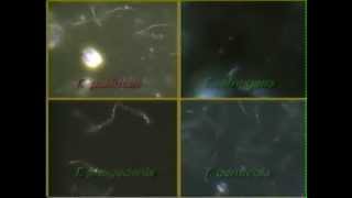 Treponema Syphilis Darkfield Video CDC [upl. by Anilet22]