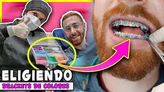 Video en 🔴Vivo 𝐏𝐎𝐍𝐈𝐄𝐍𝐃𝐎 𝐁𝐑𝐀𝐂𝐊𝐄𝐓𝐒 𝐃𝐄 𝐂𝐎𝐋𝐎𝐑𝐄𝐒 👉¿Como se ponen los BRACKETS con LIGAS DE COLORES [upl. by Gawain]