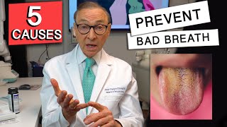 Top 5 CAUSES of BAD BREATH  How to Prevent it [upl. by Wickman926]