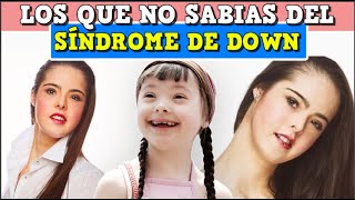 Sindrome de down  curiosidades que no sabias [upl. by Isia726]