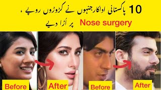 Pakistani Actors who had Nose surgery to look beautiful [upl. by Oirromed]