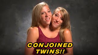 ALL YOU NEED TO KNOW About TLC Conjoined Twins Abby amp Brittany [upl. by Isborne]