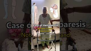 🥺 हे राम ये जीवन । Case of Hemiparesis  Wait for End physiotherapy aprc [upl. by Frymire]