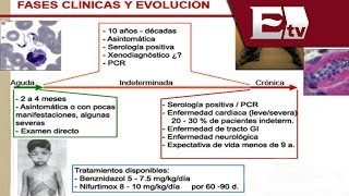 ¿Qué es la enfermedad de Chagas  Titulares con Vianey Esquinca [upl. by Ahsemed]