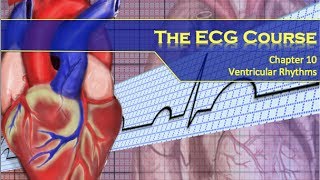 The ECG Course  Ventricular Rhythms [upl. by Ttirrej]