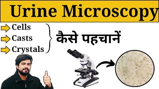 Microscopic Examination of Urine  Urine Analysis in Hindi  Crystals  Casts  Lab Practical [upl. by Ilenna]