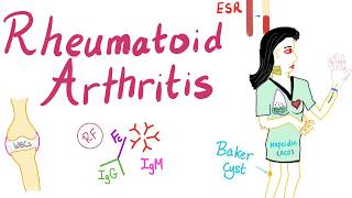 Rheumatoid arthritis Part 5 Atlantoaxial instability subluxation [upl. by Gerti110]