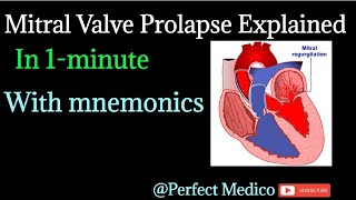 Mitral Valve Prolapse Made Easy MVP in less than 1 minute [upl. by Diraf]