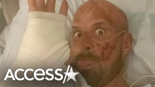 AGT Extreme’s’ Jonathan Goodwin Speaks Out After Near Death Accident [upl. by Miett]