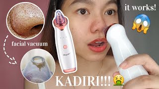 BEST PORE VACUUM CLEANER  HOW TO USE FACIAL VACUUM Success  Hello Katy [upl. by Latoniah]