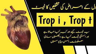 Troponin Enzymes Test in Urdu  Trop i Test  Best Test To Confirm Heart Attack [upl. by Dare]