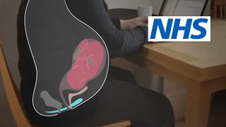 How and when should I do pelvic floor exercises  NHS [upl. by Jerman]