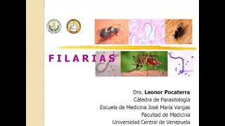 Filariasis linfática Wuchereria bancrofti  Mansonelosis [upl. by Shaefer488]