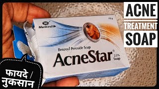 Acne Treatment Soap  AcneStar Soap Review  Soap For Acne फायदे और नुकसानकैसे लगाए Shruti Mishra [upl. by Yamauchi]