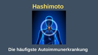 Hashimoto  die häufigste Autoimmunerkrankung Dr Volker Schmiedel im Interview mit QS24 [upl. by Anim]