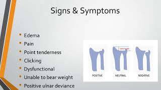 Triangular Fibrocartilage Complex Injury [upl. by Rephotsirhc]