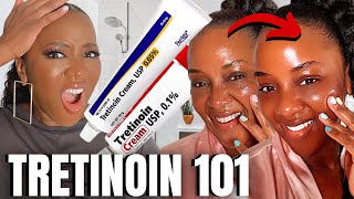 Heres how to PROPERLY Start Tretinoin [upl. by Sherer]