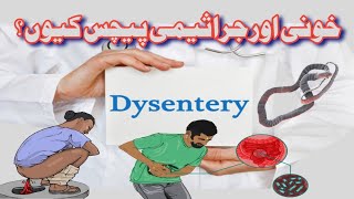 Dysentery Types I Bacillary Sign Symptoms Treatment I Faisal Shaheen [upl. by Rodrick]