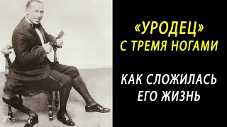 quotУродецquot с тремя ногами Как сложилась жизнь Франческо Лентини [upl. by Ynoffit]